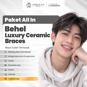 Paket All In - Luxury Ceramic Braces