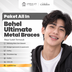 Paket All In - Behel Ultimate Metal Braces