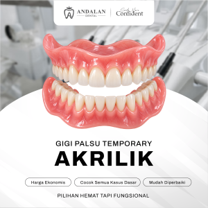 Gigi Palsu Akrilik - Andalan Dental - Klinik Gigi Pekanbaru - Dokter Gigi Pekanbaru