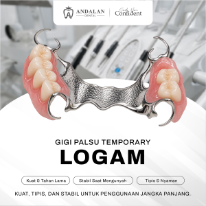 Gigi Palsu Logam - Andalan Dental - Klinik Gigi Pekanbaru - Dokter Gigi Pekanbaru